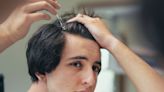 What Are the Side Effects of Topical Minoxidil for Hair Loss?