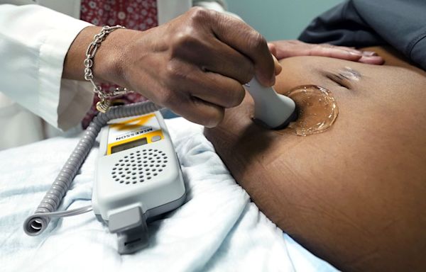 US maternal mortality rate the highest among high-income countries