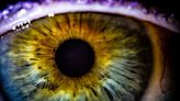 Are you one of the millions about to have cataract surgery? Here’s what ophthalmologists say you need to know