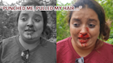 'Punched me Twice, Pulled my Hair': Pune Woman with Bleeding Face Tells Why Elderly Assaulted Her; VIDEO