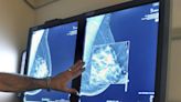 When should you start getting mammograms? Expert panel proposes changes to guidelines