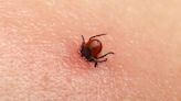 Tick Bite Symptoms