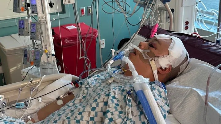 Oakland father of 2 shot in head while sleeping fighting for his life in hospital