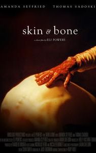 Skin & Bone