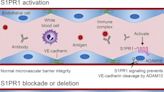 Shoring up blood vessels may offer new approach for treating autoimmune rheumatic diseases