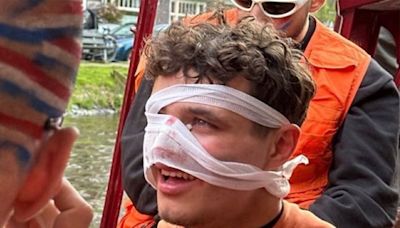 Lando Norris suffers nasty facial injury while partying in Amsterdam before Miami Grand Prix