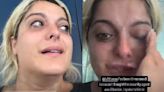 Latest entertainment News, Live Updates Today August 17, 2024: Bebe Rexha can't catch a break, says she was a ‘hate crime’ victim at Munich airport; here's what happened