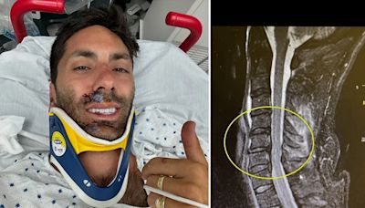 'Catfish' host Nev Schulman breaks neck in deadly bike accident