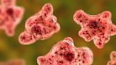 A swimmer has been hospitalized with a rare brain-eating amoeba after visiting a lake in Iowa