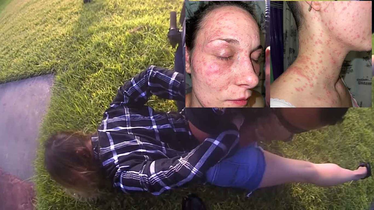 HORRIFIC IMAGES: Houston area woman claims officers held her face in fire ants, according to lawsuit