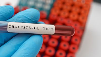 These Are the Exact Cholesterol Numbers You Should Aim for If You Want to Prevent Heart Disease, According to a Cardiologist