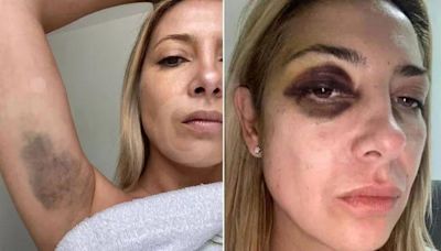 Denuncia contra Alberto Fernández: las fotos y chats de la violencia contra Fabiola Yañez