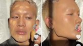 What is ‘vampire skin’? The new beauty TikTok trend replaces ‘glass skin’