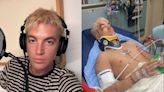 Paul Klein, da banda LANY, é hospitalizado após ser atropelado por um carro