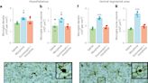 Brain neurotransmitter receptor antagonist found to prevent opioid addiction in mice