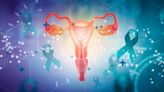 Conjugated equine estrogen may increase risk for ovarian cancer