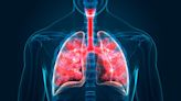 Cystic fibrosis: global clinical trials landscape and treatments