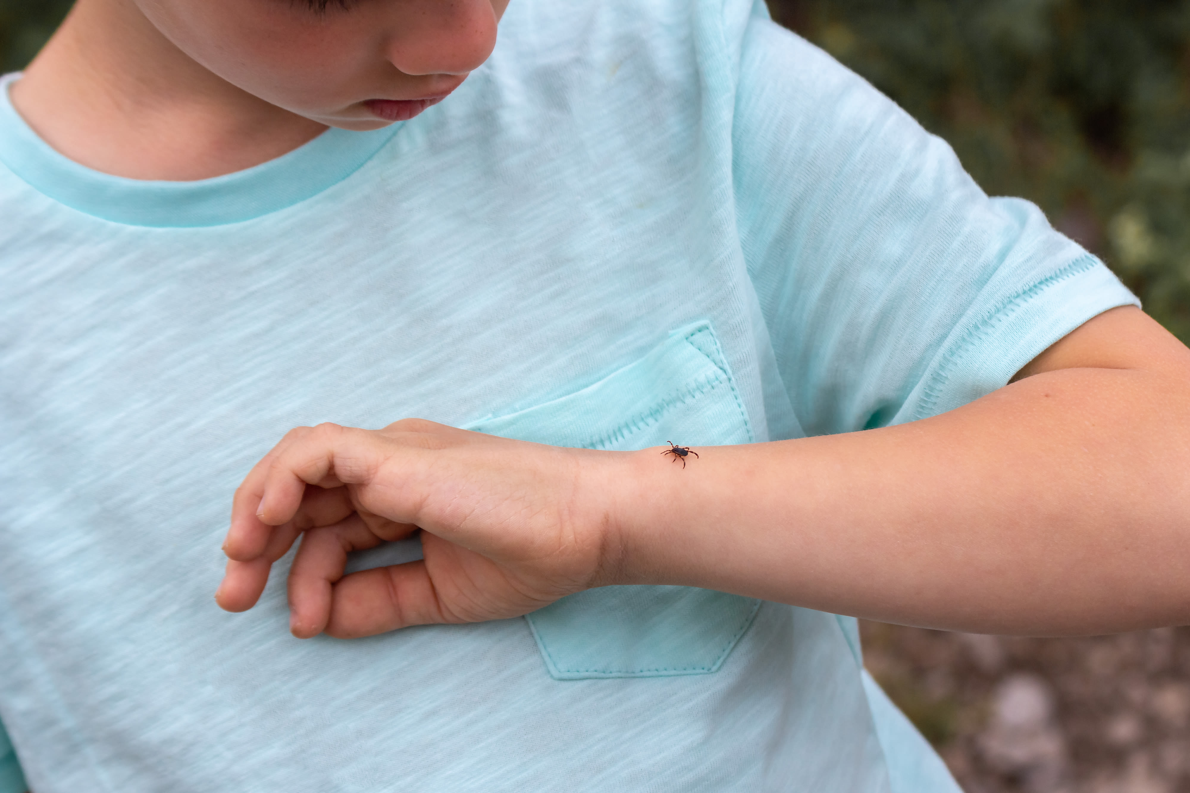 Ticks are here to stay: Expert tips on staying safe as Ontario reports 60 Lyme disease cases in 2024