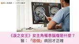 《淚之女王》女主角罹患腦瘤是什麼？醫：惡性神經膠質母細胞瘤才正確 | 蕃新聞