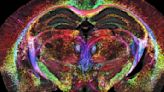 Kaleidoscopic image of a mouse's brain is 64 million times sharper than a typical MRI