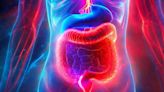 ¿Cuáles son los hábitos “saludables” que empeoran el síndrome del intestino irritable?