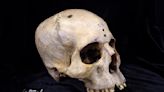 Un cráneo sugiere que la antigua medicina egipcia estudiaba el cáncer cerebral