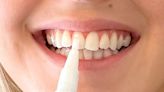 Delighted shoppers say £20 pen can whiten teeth in just one week