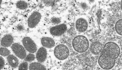 美國猴痘確診已460例 傳染病專家示警：疫情恐失控--上報