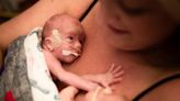 Skin-to-skin contact between mother and newborn significantly improves outcomes for premature babies