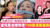 盧宛茵自爆拍TVB劇遭導演篤面挑剔演技 「怒掟毛巾」花旦小生竟扮睇唔到