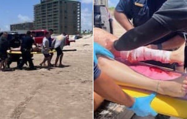 Shark attacks along Florida and Texas beaches leave several injured over holiday weekend