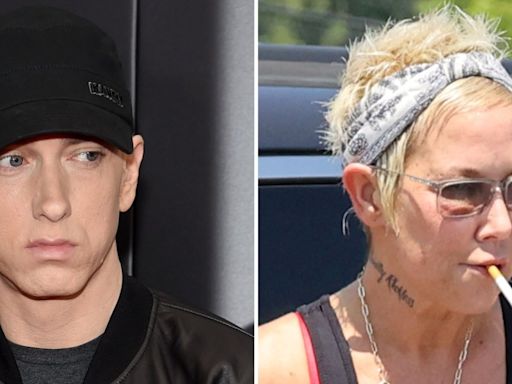 Eminem's Ex Kim Mathers Seen With Apparent Injury in Rare Outing