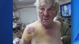 Elderly couple sues Ogden police for excessive force