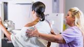 Breast cancer screening should start at age 40, expert task force says
