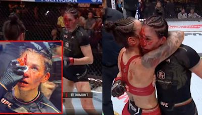 UFC 306: Irene Aldana y la TERRORÍFICA cortada en toda la cara que pone en riesgo su salud (VIDEO)