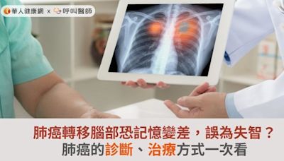 肺癌轉移腦部恐記憶變差，誤為失智？肺癌的診斷、治療方式一次看