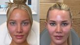 Love Island star Grace Jackson's cosmetic surgeon Dr Rosh reveals the secret to her looks