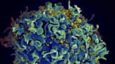 New 'vaccine-like' HIV drug could cost just $40: Researchers