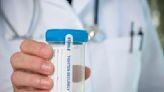 10-Panel Drug Tests on Urine, Hair, and More