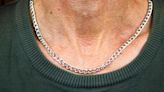 Man Saved From Near-Fatal Bullet Wound by Necklace