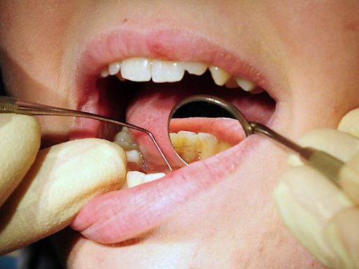 Children in most-deprived areas ‘three times more likely’ to need teeth removed