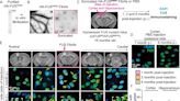 Study reveals FUS protein's role in two neurodegenerative diseases