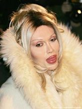 Pete Burns