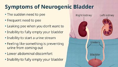 Neurogenic Bladder: What Are My Treatment Options?