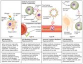 Hypersensitivity