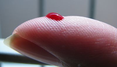 Test to check your risk of 67 diseases from a single drop of blood