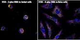 Fluorescence in situ hybridization