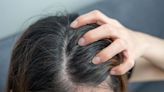 'Vintage' dandruff treatment resurfaces online – and many are amazed by results