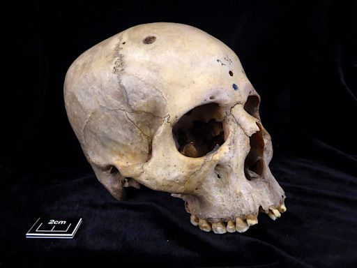 Salud: un cráneo de 4600 años sugiere que los egipcios ya buscaban tratar una enfermedad que aún desafía a la medicina