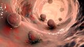 AI-Assessed Bowel Prep Helps Ensure Successful Colonoscopy